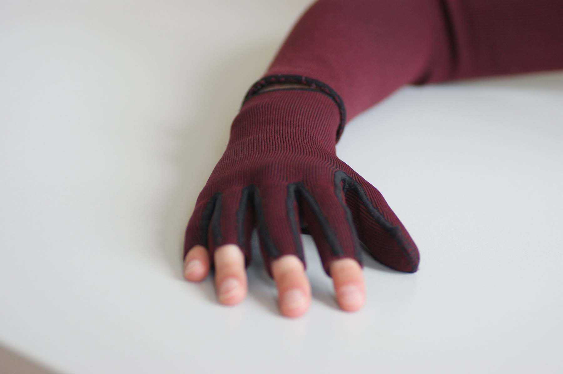 Photo of pressure garments on hand and arm
